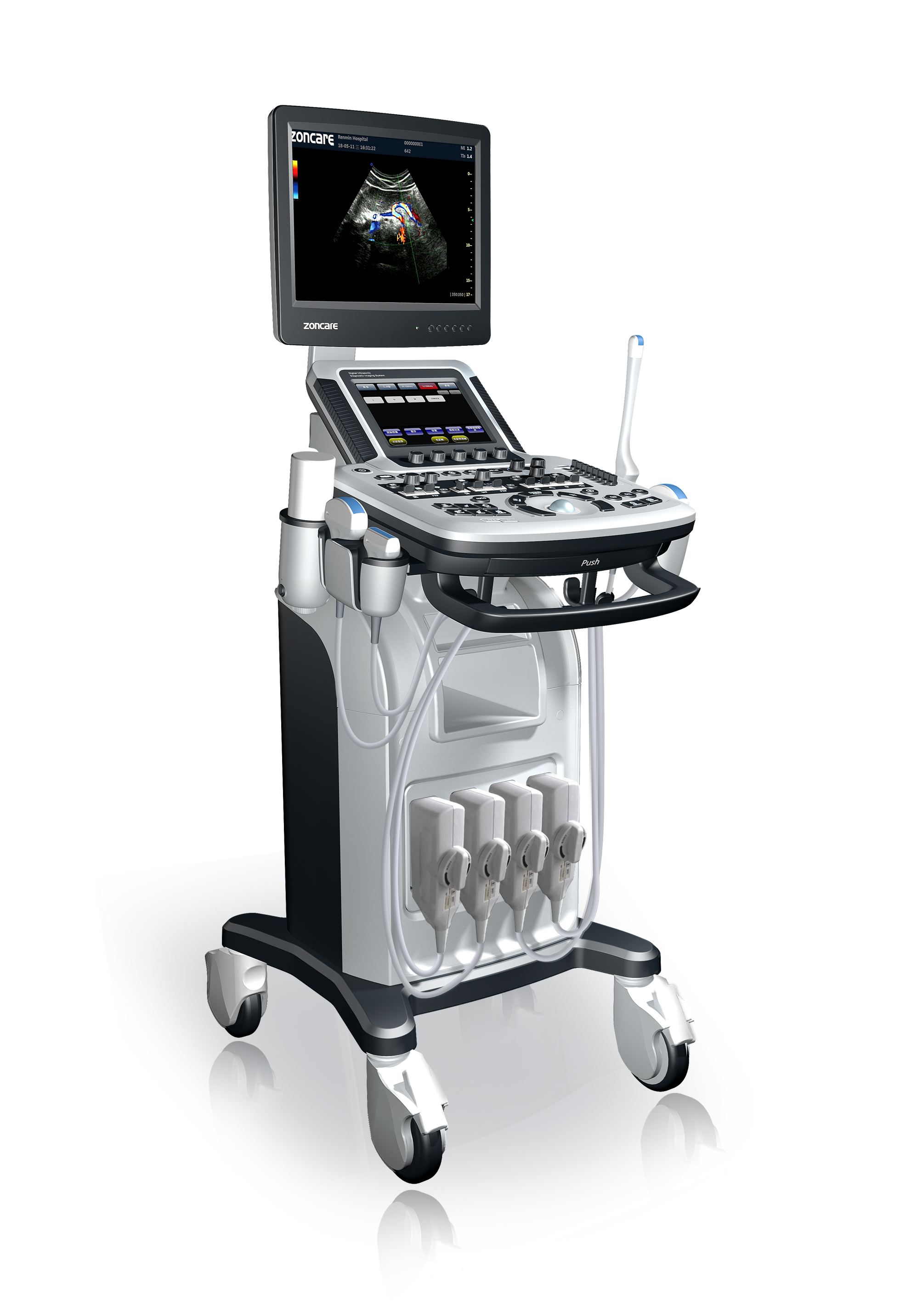 USG 4D Zoncare Q3