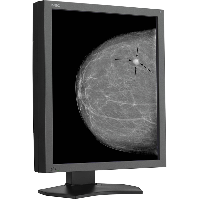 NEC MD215MG 21" Grayscale 5MP Medical Diagnostic Monitor Ampronix Inc.