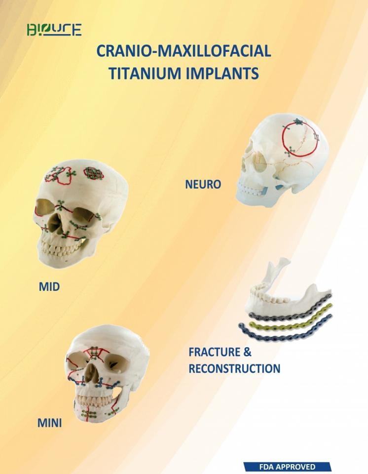CranioMaxillofacial Titanium植入物G.R.Bioure手术系统私人有限公司 beplay官网苹果