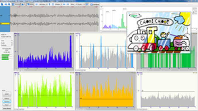 EEG Biofeedback module for EEG devices EEG Biofeedback module for EEG devices