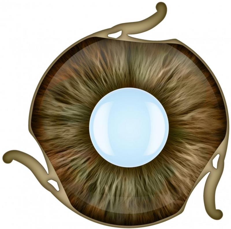 Artificial iris ReperNN Ltd