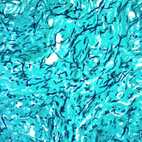 gms stain