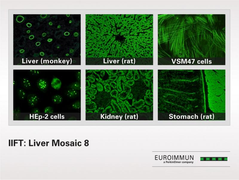 IIFT Liver Mosaic 8 IIFT Liver Mosaic 8