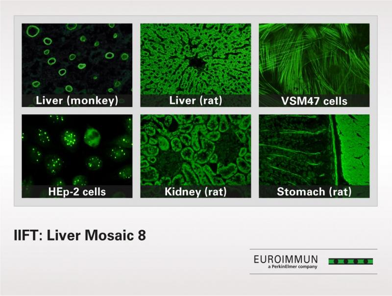 IIFT肝脏马赛克8