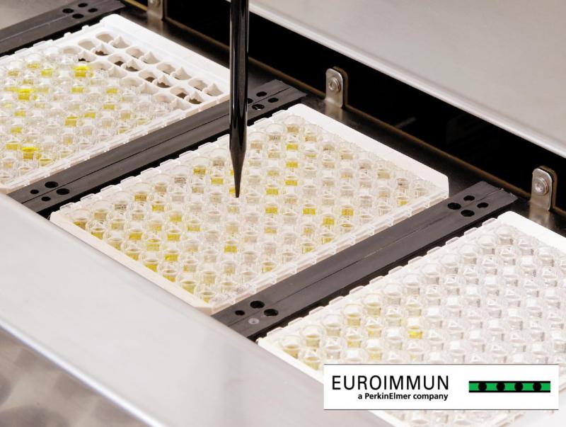 Uromodulin ELISA Uromodulin ELISA