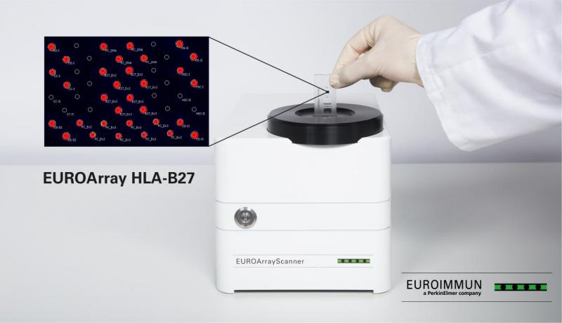 EUROArray HLA-B27 Direct EUROArray HLA-B27 Direct