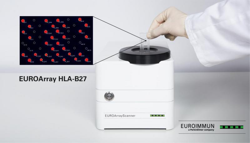 EUROArray HLA-B27直接