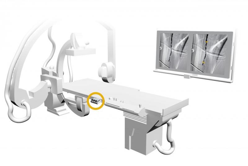 StentMarker stenting peripheral interventions