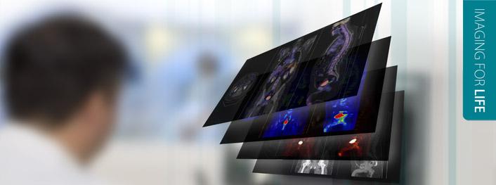Multimodality Imaging Mediso - Mediso Medical Imaging Systems Multimodality Imaging Mediso - Mediso Medical Imaging Systems