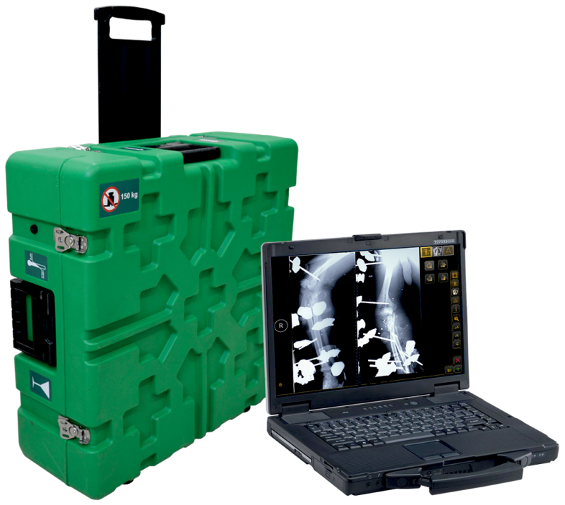 DIARM™ MW Mobile DR Suitcase System