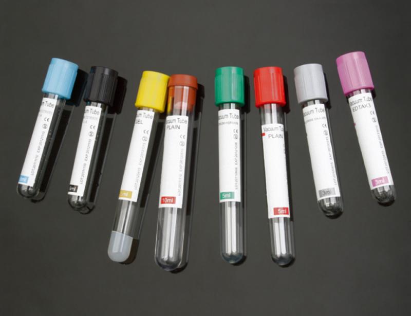 Vacuum Blood Collection Ningbo Greatcare Trading Co Ltd