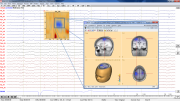 Review window with Beamforming