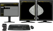 DIARM™ DM Mammography Workstation